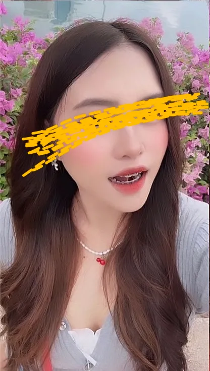 แพท patt นศษ ปี2 จิง